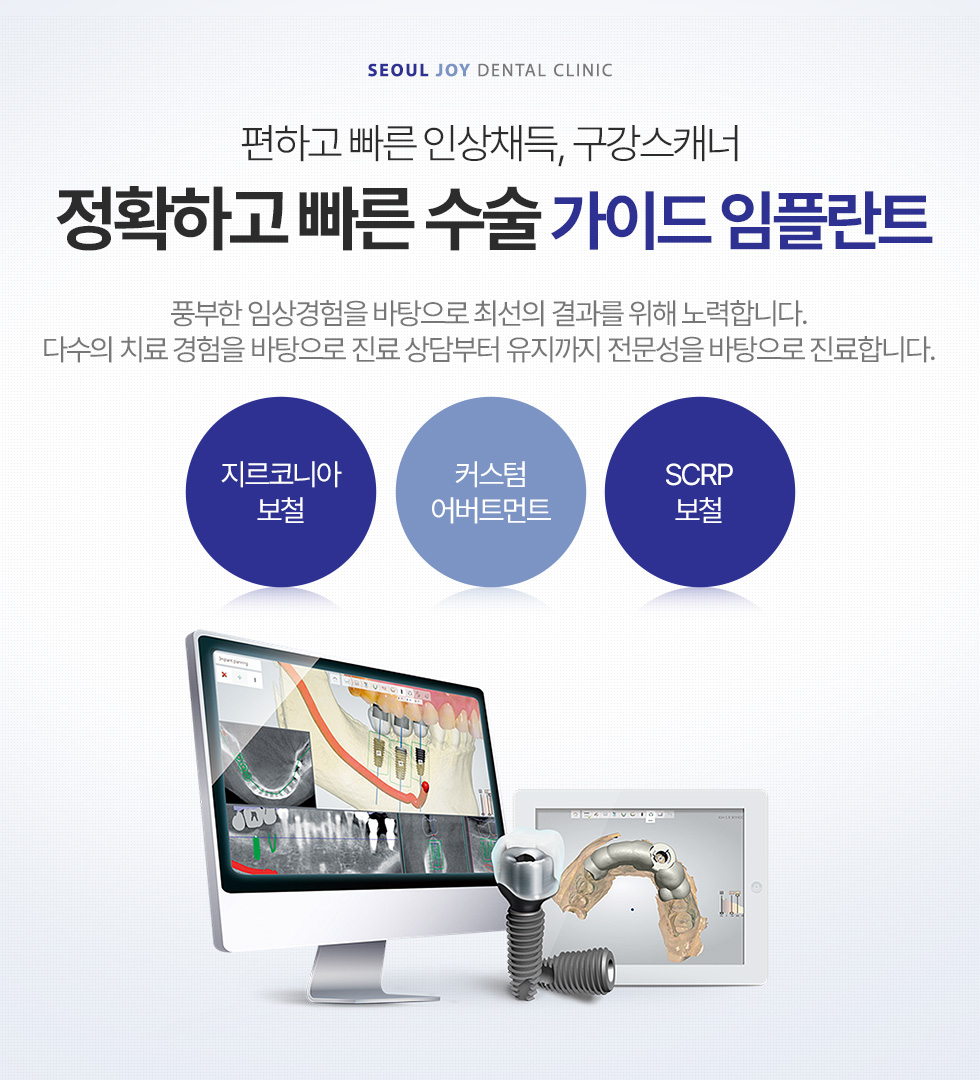 편하고 빠른 인상채득, 구강스캐너 정확하고 빠른 수술, 가이드 임플란트